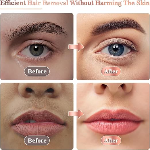 Depilador facial - El original