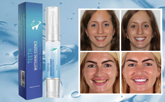 EL MEJOR LAPIZ BLANQUEADOR DE DIENTES